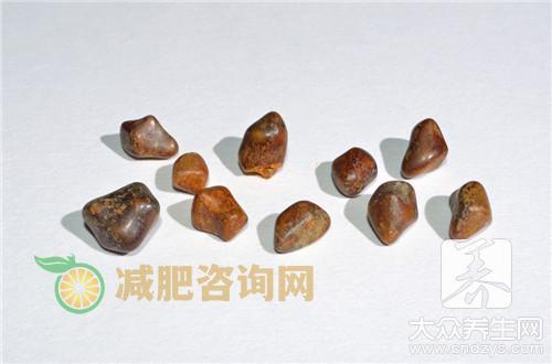 胆结石1.5cm需要手术吗？