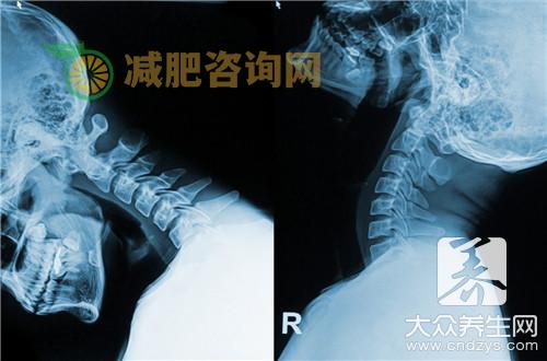 颈椎痛拔罐 方法上的技巧